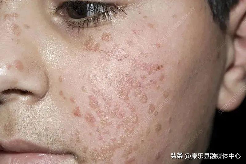 第225页